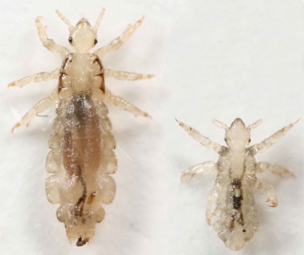 Can Head Lice Survive on Clothes